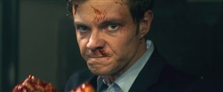 novocaine-final-trailer Video Thumbnail
